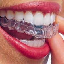 Consulte nuestras promociones y ofertas mensuales en todos los tratamientos de Ortodoncia Invisible. Brackets transparentes. Alineadores Dentales invisibles. Consulte nuestros Precios y Presupuestos económicos para Familias Númerosas en Clínica Dental Maján Dentista en Móstoles 2021
