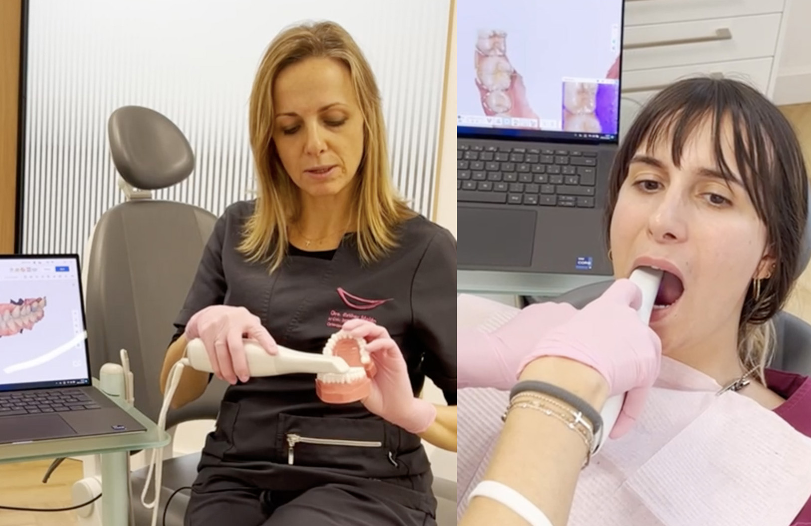 CLINICA DENTAL ESTHER MAJAN, SIEMPRE A LA VANGUARDIA DE NUEVAS TECNOLOGÍAS QUE FACILITEN Y OPTIMICEN LOS TRATAMIENTOS DENTALES DE NUESTROS PACIENTES. OS PRESENTAMOS LAS VENTAJAS DEL ESCÁNER INTRAORAL FRENTE A LA TOMA CONVENCIONAL DE IMPRESIONES EN EL TRATAMIENTO ORTODÓNCICO (ORTODONCIAS): Los modelos son más fiables, ya que no existe una interfase entre la impresión y el yeso además de evitar discrepancias que pueda haber entre la impresión y el modelo. Rapidez en la obtención de modelos digitales tridimensionales frente a unos de escayola. No es necesario tener un espacio para el almacenamiento de los modelos habilitado y sin riesgo de daño o pérdida de los modelos de yeso. No tenemos que tener en cuenta las alergias a los materiales en la toma de impresión. Posibilidad de combinar las cefalometrías 3D obtenidas por CBCT y los modelos digitales 4,5. Reduce el riesgo de contaminación cruzada gracias a la utilización de boquillas desechables monouso. Ofrece mayor comodidad a los pacientes, sobre todo en aquellos con reflejo nauseoso, disfunciones respiratorias o malformaciones congénitas (labio leporino, EPOC, paladar hendido, etc.). Reduce el gasto económico en materiales para toma de impresiones. Capacidad para realizar tratamientos ortodóncicos con aparatología individualizada. Facilita la explicación de los tratamientos a los pacientes, mejorando la comunicación con estos y su comprensión de los objetivos de tratamiento. Mejora la planificación del caso, la detección de interferencias oclusales y el análisis del tamaño dentario de manera informatizada. “Clínica Dental de la Dentista Dra. Esther Maján en Móstoles”. Dirección: Calle del Pintor Picasso 5 (Posterior) 28932 Móstoles (Madrid). Nuestro horario habitual es: De Lunes a Jueves de 9 a 20:00 H y Viernes de 9:00 a 19:00 H. Centro Dental Consultorio Odontológico en Mostoles con excelentes opiniones de nuestros pacientes. Teléfonos Contacto de nuestros dentistas: 91 617 12 22 / 681 117 888. E-mail contacto contacto@clinicamajan.com Centro Dental Consultorio Odontológico en Mostoles con reconocidos Dentistas Ortodoncistas Higienistas Odontopediatras Odotopediatría y con excelentes opiniones de nuestros pacientes. https://www.clinicamajan.com #DentistaMóstoles #DentistasMóstoles #ClinicaDentalMóstoles #ClínicasDentalesMóstoles #OrtodoncistaMóstoles #OrtodoncistasMóstoles #TratamientosDentalesMóstoles #OrtodonciasInvisibles #OrtodoncistasMóstoles #PresupuestosOrtodonciasInvisiblesInvisalign #TratamientosDentalesEconómicosMóstoles #ClinicasDentalesRecomendables #ClinicasDentalesRecomendadasMóstoles #MejorClínicaDentalMóstoles #MejoresDentistasMóstoles #DentistasEspañolesMóstoles #TacDentalesMóstoles #RadiografíasBucalesMóstoles #OdontopediatríaMóstoles #RevisionesDentalesNiñosMóstoles #DentistasNiñosAdolescentesMóstoles #OfertasTratamientosDentalesMóstoles #PromocionesOfertasFamiliasNumerosasDentistasMóstoles #ClínicasDentalesOfertasFamiliasNumerosas #RadiografíasDentalesMóstoles #TacDentalesMóstoles #TelerradiografíasMóstoles #tacsbucales #Radiografías3DMóstoles #RadiografíasBucalesMóstoles #PruebasRadiológicasDentales #PruebasDentatesMóstoles #DentistasMóstoles #ClínicasDentalesMóstoles #OrtodonciasInvisiblesMóstoles #OfertasOrtodonciasInvisibles #OrtodonciaInvisibleZonaSurMadrid #PresupuestosOrtodonciasInvisibles #OfertasOrtodonciasInvialign #PromocionesOrtodonciasInvisalign #DescuentosOrtodonciasInvisialign #OrtodonciasMóstoles #OrtodonciasMóstolesMadrid #OrtodonciasAlignersInvisiblesTransperentesMadrid #OdontologosMóstoles #EsteticaDentalMóstoles #DentistasEstéticos #CosméticaDentalMóstoles #ClinicasDentalesMóstoles #EndodonciasMóstoles #EndodonciaEconómicasMóstoles #PreciosPresupuestosEndodonciasMóstoles #DentistasEndodonciasMóstoles #ClínicasDentalesMóstoles #OdontopediatríaMóstoles #OdontopediatrasMóstoles #DentistasNiñosMóstoles #ClínicasDentalesNiñosMóstoles #RevisionesDentalesNiñosMóstoles #dentistasmóstoles Como clínica dental prestamos todo tipo de servicios de tratamientos dentales con dentistas odontólogos con gran experiencia para todo tipo de clientes de todos los barrios, urbanizaciones y distritos de Móstoles, como son el parque coímbra, colonia guadarrama del distrito oeste, distrito centro que abarca el ayuntamiento, la plaza del pradillo y sus zonas limítrofes, también en la zona norte-universidad, en los barrios como los rosales, estoril II, iviasa ii, las nieves, corona verde, la princesa, la carcavilla, la luna, parque vosa y el recreo. También en la zona sur-este villafontana, estoril I, cerro prieto, pinar de móstoles, la loma, el soto, san fernando, villaeuropa, hospital y pinares llanos, etc. Distrito 1, denominado Centro, que comprende el Casco Antiguo, delimitado por la Avda. de Portugal, calle Baleares, calle Las Palmas y calle Oviedo, incluyendo estas últimas calles. Sede: Calle San Antonio, nº 2. Distrito 2, denominado Norte-Universidad, que comprende el ámbito situado entre la carretera de Villaviciosa y la zona norte de la Avda. de Portugal. Avenida Alcalde de Móstoles. Distrito 3, denominado Sur-Este, que comprende el ámbito situado entre la Avda. de Portugal, la calle Baleares, la calle Las Palmas y la calle Moraleja de en medio. Calle Libertad, Pau Móstoles Sur. Distrito 4, denominado Sur-Oeste, que comprende los barrios de El Soto, Villaeuropa, Pinares Llanos, Azorín, Barrio de San Fernando, Sotoverde, calle Huesca, zona del Hospital, Polígono Industrial nº 1 y aledaños. Calle Granada. Distrito 5, denominado Parque Coimbra-Colonia Guadarrama y que comprende dichas zonas de Móstoles. CLINICA DENTAL EN MOSTOLES – CLINICAS DENTALES EN MOSTOLES – DENTISTAS EN MOSTOLES – DENTISTA EN MOSTOLES – DENTISTA MOSTOLES – DENTISTAS MOSTOLES – DENTISTAS ECONOMICOS BARATOS EN MOSTOLES – CLINICAS DENTALES ECONOMICAS BARATAS EN MOSTOLES – DENTISTA CON BUENAS OPINIONES EN MOSTOLES – DENTISTAS CON BUENAS OPINIONES EN MOSTOLES – CLINICA DENTAL CON BUENAS OPINIONES EN MOSTOLES – CLINICAS DENTALES CON BUENAS OPINIONES EN MOSTOLES – CLÍNICA DENTAL EN MÓSTOLES – CLÍNICAS DENTALES EN MÓSTOLES – DENTISTAS EN MÓSTOLES – DENTISTA EN MÓSTOLES – DENTISTA MÓSTOLES – DENTISTAS MÓSTOLES – DENTISTAS ECONÓMICOS BARATOS EN MÓSTOLES – CLÍNICAS DENTALES ECONÓMICAS BARATAS EN MÓSTOLES – DENTISTA CON BUENAS OPINIONES EN MÓSTOLES – DENTISTAS CON BUENAS OPINIONES EN MÓSTOLES – CLÍNICA DENTAL CON BUENAS OPINIONES EN MÓSTOLES – CLÍNICAS DENTALES CON BUENAS OPINIONES EN MÓSTOLES – CLÍNICA DENTAL CON PRECIOS ESPECIALES, OFERTAS, PROMOCIOINES Y DESCUENTOS PARA FAMILIAS NUMEROSAS EN MOSTOLES (MADRID) – CLÍNICAS DENTALES CON PRECIOS ESPECIALES, OFERTAS, PROMOCIONES Y DESCUENTOS PARA FAMILIAS NUMEROSAS EN MÓSTOLES (MADRID). DENTISTAS EN MOSTOLES – DENTISTA EN MOSTOLES – DENTISTA MOSTOLES – DENTISTAS MOSTOLES – DENTISTAS ECONOMICOS BARATOS EN MOSTOLES – CLINICAS DENTALES ECONOMICAS BARATAS EN MOSTOLES – ORTODONCISTA EN MOSTOLES – ORTODONCISTAS EN MOSTOLES – BUEN DENTISTA EN MOSTOLES – BUENA CLINICA DENTAL EN MOSTOLES – DENTISTA RECOMENDABLE EN MOSTOLES – DENTISTAS RECOMENDABLES EN MOSTOLES – CLÍNICA DENTAL EN MÓSTOLES – CÍINICAS DENTALES EN MÓSTOLES – DENTISTAS EN MÓSTOLES – DENTISTA EN MÓSTOLES – DENTISTA MÓSTOLES – DENTISTAS MÓSTOLES – DENTISTAS ECONÓMICOS BARATOS EN MÓSTOLES – CLÍNICAS DENTALES ECONÓMICAS BARATAS EN MÓSTOLES – ORTODONCISTA EN MÓSTOLES – ORTODONCISTAS EN MÓSTOLES – BUEN DENTISTA EN MÓSTOLES – BUENA CLÍNICA DENTAL EN MÓSTOLES – DENTISTA RECOMENDABLE EN MÓSTOLES – DENTISTAS RECOMENDABLES EN MÓSTOLES – DENTISTAS CON PRECIOS ESPECIALES, OFERTAS, PROMOCIOINES Y DESCUENTOS PARA FAMILIAS NUMEROSAS EN MOSTOLES (MADRID) – DENTISTA CON PRECIOS ESPECIALES, OFERTAS, PROMOCIONES Y DESCUENTOS PARA FAMILIAS NUMEROSAS EN MÓSTOLES (MADRID). IMPLANTES Y PRÓSTESIS DENTALES EN MÓSTOLES. “Clínica Dental de la Dentista Dra. Esther Maján en Móstoles”. Dirección: Calle del Pintor Picasso 5 (Posterior) 28932 Móstoles (Madrid). Nuestro horario especial para la semana del 26 al 30 de diciembre es el siguiente: L y M: Cerrado. X: 9:30 a 13:00 / 14:30 a 20:00. J: 09:30 a 20:00. V: 9:00 a 14:00 / 15:00 a 19:00 H. Disculpen las molestias. Centro Dental Consultorio Odontológico en Mostoles con excelentes opiniones de nuestros pacientes. Teléfonos Contacto de nuestros dentistas: 91 617 12 22 / 681 117 888. E-mail contacto contacto@clinicamajan.com Tipos de implantes Subperiósticos o yuxtaóseos Constan de unos dispositivos en forma de silla de montar que se colocan entre el periostio y el hueso alveolar. Consta también de unos pilares donde se ancla la prótesis. Se emplean poco, estando indicados en casos de mandíbula con una gran reabsorción ósea. Implante cilíndrico roscado. Implante pterigoideo Pterigoideos Son implantes de unos de 15 mm que se introducen en el maxilar superior a nivel del 2.º molar y que transcurren por la tuberosidad posterior alveolar, hueso palatino y finalmente se anclan el al apófisis pterigoides del esfenoides. Son muy útiles en caso de rehabilitación en maxilares atróficos. Cigomáticos Son implantes autorroscantes de longitudes entre 30 a 52,5 mm y una cabeza angulada de 45° que se introducen en el hueso cigomático. Su porcentaje de éxito varia entre 80 y 95 % .Son una alternativa a los injertos de hueso en maxilar atróficos. Este tipo de implantes dentales están especialmente indicados para todas aquellas personas con falta de masa ósea en el maxilar, es decir, con un alto grado de atrofia ósea. La atrofia ósea se da cuando el hueso no dispone ni de la altura ni de la anchura necesaria como para apoyar los implantes dentales. La pérdida de hueso es muy común en personas que han usado prótesis dentales durante muchos años, provocando la atrofia ósea. Otro caso muy común de atrofia es la debida a la enfermedad periodontal severa. Con anterioridad a la aparición de los implantes cigomáticos la única solución viable era la realización de un injerto de hueso. Se tratan de implantes más largos que los normales, de manera que estos se anclan a la parte interior del hueso cigomático o hueso de la mejilla. El hueso molar tolera las fuerzas de la masticación, cuando los implantes cigomáticos están conectados a una prótesis dental fija. Se trata por lo tanto de un hueso de buena calidad con un volumen suficiente en todos los pacientes. Los implantes cigomáticos deben ser colocados por equipos expertos de cirujanos maxilofaciales. Dichos implantes de se colocan bajo anestesia general siempre después de un completo examen quirúrgico y un estudio oral integral completo, que debe incluir modelos dentales del paciente, rayos X y fotos dentales. Pronóstico de éxito y principales complicaciones de los implantes cigomáticos1​[editar] En comparación con los injertos óseos, los implantes cigomáticos presentan mejores resultados. Su ratio de éxito ronda el 97%. La principal razón radica en que el hueso cigomático brinda la oportunidad de fijar mejor los implantes. Poner unos implantes cigomáticos es más rápido y sencillo, pero sobre todo, presenta menos morbilidad que otros. La complicación más usual es la sinusitis, pero apenas se da en el 3% de los pacientes y habitualmente se resuelve con el uso de antibióticos. Otras complicaciones que pueden ocurrir, aunque de manera muy poco habitual son: Que el implante no se adhiera correctamente al hueso. Que la herida sangre de manera no habitual. Daños poco habituales en los tejidos blandos. Deterioro en las estructuras anatómicas vecinas, como por ejemplo en la órbita ocular. Como en cualquier tipo de intervención en los que se requiere de cirugía, el proceso de colocación de los implantes cigomáticos puede acarrear complicaciones como infecciones y problemas con la anestesia, pero se dan en muy raras ocasiones. Endoóseos Estos implantes van introducidos en el hueso alveolar, y, según su forma, se distinguen: Cilíndricos Por fricción De superficie no roscada cubierta normalmente por una capa de hidroxiapatita (retención química), algunos «modelos» tienen perforaciones con el fin de que el hueso se desarrolle en su interior y se fije (retención mecánica), estos últimos no son muy usados, pues es muy lento el proceso. Su biomecánica es peor que los roscados (un buen símil sería: ¿qué se ancla mejor a la madera, un clavo o un tornillo?). Roscados Presentan aspecto de tornillo, con una rosca en su superficie, con lo que se consigue aumentar la superficie de contacto del implante con el hueso. Radiografía donde se ve un modelo de implante de lámina perforada. Láminas perforadas Son láminas de titanio con perforaciones que permiten el crecimiento del hueso a través de los mismos. Llevan pilares soldados donde se anclarán las prótesis. Están indicadas para pacientes cuya anchura del hueso alveolar es muy escasa para colocar un implante cilíndrico. Mini Implantes Conocidos también como minitornillos o en inglés Temporary Anchorage Devices (TAD) son utilizados para corregir cierto tipo de maloclusiones y conseguir la mordida perfecta. Este tipo de aparatología se inició a utilizar a principios del siglo XXI como un auxiliar para ayudar a mantener el anclaje en ortodoncia evitando ciertos movimientos no deseados y facilitando mucho la mecánica durante el tratamiento de ortodoncia. El diseño consiste en un tornillo de titanio o acero inoxidable de entre 8 a 12 mm de largo por 1 a 2 mm de grosor el cual se introduce dentro de zonas seguras del hueso alveolar de los maxilares superior e inferior. El uso de estos tornillos permite corregir maloclusiones dentales tales como mordida abierta, mordida cruzada y prognatismo mandibular entre otras. Los minimplantes pueden ser utilizados con cualquier tipo de técnica, bracket, paladar de ortodoncia o alineador invisible que se decida utilizar. Implantes corticales Estos implantes surgieron como solución a las situaciones en las que hay ausencia de hueso o poca masa ósea. Para conseguirlo, se coloca una férula en el área cortical con pequeños tornillos, para posteriormente ubicar los implantes en la férula. Estos implantes se fijan exitosamente debido a que la férula puede moldearse y se adapta a la forma ósea de cada paciente. Material del implante Materiales del implante dental Titanio Es el más empleado para implantes por su alta estabilidad química y buenas propiedades de biocompatibilidad. Mecánicamente, su dureza le permite soportar elevadas cargas oclusales producidas durante la masticación, y su módulo elástico es muy parecido al del hueso. Los implantes pueden ser fabricados de titanio puro, o con titanio en aleación con aluminio o vanadio. Este material, permite la osteointegración del implante, siempre que su superficie no sea lisa. Materiales cerámicos Implante dental blanco monolítico de zirconio. El más usado es la hidroxiapatita, que se emplea para cubrir la superficie de implantes de titanio. Existen implantes fabricados completamente con materiales cerámicos, como son aquellos hechos exclusivamente con óxido de aluminio monocristalino. También están apareciendo en el mercado implantes de dióxido de zirconio (ZrO2) llamados comúnmente zirconio. Actualmente se considera que este material tiene un gran potencial para ser usado en la odontología moderna. Otra variante sería el dióxido de zirconio estabilizado con itrio. Estos materiales permiten una integración más rápida y fuerte que la producida con el titanio, ya que la unión no es mecánica, sino supuestamente química —algo todavía no contrastado científicamente—, dando lugar a la biointegración. Implante dental cónico. Implante dental cilíndrico. Implante de conexión interna. Implante de conexión externa. Prótesis dental atornillada. Prótesis dental cementada. Implantes Osteointegrados ¿Qué es un implante dental? Son raíces artificiales de titanio que sustituyen a las raíces naturales de los dientes. Sobre los implantes se colocarán los nuevos dientes que proporcionan los mejores resultados funcionales, estéticos y duraderos. ¿Para que sirven los implantes? Los implantes ósteointegrados constituyen una nueva técnica que ha revolucionado los tratamientos odontológicos ampliando de esta manera las alternativas de realizar la reposición de piezas dentarias perdidas ya sea en forma fija o removible con un alto grado de satisfacción estética y funcional para el paciente. La técnica de Implantes requiere en forma previa de un estudio clínico-radiológico del estado óseo de los maxilares del paciente donde serán instalados los implantes, de tal modo que se puedan establecer el mejor tratamiento. ¿Cuáles son las ventajas de usar implantes dentales? Ofrecen un aspecto y una funcionalidad muy similar a los dientes naturales, gran comodidad, seguridad y confianza. Mantienen la anatomía facial ya que la ausencia de otros dientes suele conllevar una pérdida progresiva de hueso del maxilar o mandíbula. Los implantes dentales ayudan a frenar esa pérdida y facilitan el mantenimiento de su anatomía facial. Mantienen sus dientes sanos: los implantes dentales permiten reponer una pieza dental sin tener que tallar los dientes vecinos como ocurre con las fundas y puentes tradicionales. ¿Alguien notará que llevo implantes? No. Es prácticamente imposible distinguir un diente natural de un diente soportado por un implante dental, probablemente conozca a personas a su alrededor que son portadores de implantes dentales y usted no lo haya notado. ¿De qué material están fabricados los implantes? La práctica totalidad de los implantes que hay en el mercado están fabricados con Titanio comercialmente puro (Ti cp), en el caso de los implantes Mozo-Grau, están fabricados con Titanio Grado IV pues es el titanio que mejor relación tiene entre la resistencia a las fuerzas masticatorias y flexibilidad. ¿Por qué los implantes dentales están fabricados con titanio? El titanio es un metal biocompatible, bioinerte, estable, con capacidad de integrarse en el hueso (osteointegración) y muy buena tolerancia por parte de los tejidos blandos. ¿Si soy alérgico a los metales es posible que rechace el implante dental? El titanio con el que están fabricados los implantes dentales es un metal que no ha demostrado ninguna reacción toxica ni irritativa sobre el tejido vivo, esto quiere decir que el organismo no lo reconoce como un cuerpo extraño, por lo tanto, las posibilidades de que se produzca una reacción de rechazo o de alergia a este tipo de material es prácticamente imposible. ¿Me los puedo poner inmediatamente? Los implantes se pueden colocar en el mismo acto quirúrgico de la extracción de un diente, tras un traumatismo o después de un tiempo sin tener una pieza dental. Esto siempre dependerá de la cantidad y calidad ósea que será diagnosticada por el implantólogo mediante un CBCT (Escáner de haz cónico o Radiografía en 3D). ¿Si tengo alguna enfermedad, puedo usarlos? Enfermedades como la Diabetes, Osteoporosis no constituyen contraindicaciones absolutas siempre y cuando sean enfermedades que estén controladas por su médico por lo que deberá informar a su especialista para que pueda tomar la decisión correcta. ¿Cuánto puede durar el proceso? La duración del proceso va a depender de muchos factores, la salud general de paciente, la salud bucodental, la densidad ósea, el protocolo quirúrgico, etc. Son muchos los factores que van a influir en la duración del tratamiento. En algunas situaciones se podrá realizar en un día y en otras se tardara varios meses. Lo más importante es que el implante se integre al hueso correctamente (osteointegración). ¿Qué cuidados debo tener cuando me han colocado los implantes dentales? Durante el proceso posterior a la colocación de los implantes, usted debe de evitar situaciones que comprometan el tratamiento como lo son: infecciones o fumar. Una correcta higiene y una cuidada salud periodontal evitaran la aparición de infecciones. Los fumadores tienen un mayor riesgo de alterar el proceso de osteointegración pues el tabaco es un vasoconstrictor que va disminuir el aporte sanguíneo por lo que altera el proceso normal de osteintegración y aumentará la posibilidad de que el implante fracase. Realizar excesiva fuerza sobre el implante recién colocado que puede ocasionar que se mueva y esto rompería con el proceso de osteointegración, por esta razón, deberá estar muy atento a la dieta que le indica su especialista. Una vez que el tratamiento ha terminado, deberá tener los mismos cuidados en cuanto a higiene que con sus dientes naturales. En cualquier caso, será su Dentista o Cirujano Maxilofacial quien le aconseje sobre los cuidados que debe tener. ¿Es un tratamiento doloroso? No. Es una cirugía que se suele realizar con anestesia local y en ocasiones con sedación o anestesia general. Cuando los efectos de la anestesia van desapareciendo puede ser que usted perciba algún tipo de leve molestia, inflamación o hematoma, que puede ser aliviada con medicamentos comunes y se podrá incorporar a su vida normal el mismo día de la intervención o a los pocos días. El propósito principal de esta intervención, es la reposición de los dientes perdidos. El procedimiento se lleva a cabo en dos fases. En la primera, se fijan los tornillos al hueso mediante fresas preparando un lecho o alvéolo artificial y en la segunda (pasados varios meses cuando el hueso y el tornillo estén integrados) se coloca un pilar sobre ellos, para recibir posteriormente los aditamientos protésicos. En Clinica Dental Esther Maján, disponemos de un área especializada de odontopediatría con odontólogos pediatras especializados en revisiones y todo tipo de tratamientos dentales para niños y jóvenes. En Clínica Dental Esther Maján, cuidamos de la salud dental de sus hijos mediante el control y la aplicación de las últimas tecnologías en el ámbito dental para los niños y jóvenes tengan sus dientes perfectos. En este sentido, además una salud bucal es un síntoma de una óptima salud general y para ello trabajan nuestros dentistas pedriatrícos. Consúltenos y estableceremos un protocolo a través de nuestros odontopediatras para evaluar y controlar el desarrollo de la dentadura de sus hijos y así evitar problemas futuros. ODONTOPEDIATRÍA ESPECIALIZADA EN CLÍNICA DENTAL ESTHER MAJÁN. ESPECIALISTAS EN REVISIONES INFANTILES Y TRATAMIENTOS DENTALES PARA NIÑOS Y JÓVENES. CLINICAS DENTALES ESPECIALIZADAS EN NIÑOS EN MÓSTOLES, Dentistas para niños en Móstoles, DENTISTAS PEDIÁTRICOS EN MÓSTOLES, FERULAS ORTODÓNTICAS INFANTILES, Odontopediatras en Móstoles, ORTODONCIAS BRACKETS PARA NIÑOS Y JÓVENES EN MÓSTOLES, PRESUPUESTOS TAC DENTALES PARA NIÑOS, PRESUPUESTOS TRATAMIENTOS DENTALES ORTODONCIAS PARA NIÑOS EN MOSTOLES, REVISIONES DENTALES INFANTILES NIÑOS EN MOSTOLES, SERVICIO DE ODONTOPEDIATRÍA EN MÓSTOLES, TRATAMIENTOS DENTALES PARA NIÑOS JÓVENES EN MOSTOLES CLINICAS DENTALES ESPECIALIZADAS EN NIÑOS EN MÓSTOLES, DENTISTAS PARA NIÑOS EN MÓSTOLES DENTISTAS PARA NIÑOS EN MÓSTOLES, DENTISTAS PEDIÁTRICOS EN MÓSTOLES DENTISTAS PEDIÁTRICOS EN MÓSTOLES, FERULAS ORTODÓNTICAS INFANTILES EN MÓSTOLES FERULAS ORTODÓNTICAS INFANTILES EN MÓSTOLES, ODONTOPEDIATRAS EN MÓSTOLES ODONTOPEDIATRAS EN MÓSTOLES, ORTODONCIAS BRACKETS PARA NIÑOS Y JÓVENES EN MÓSTOLES ORTODONCIAS BRACKETS PARA NIÑOS Y JÓVENES EN MÓSTOLE, REVISIONES DENTALES INFANTILES NIÑOS EN MOSTOLES REVISIONES DENTALES INFANTILES NIÑOS EN MOSTOLES, SERVICIO DE ODONTOPEDIATRÍA EN MÓSTOLES SERVICIO DE ODONTOPEDIATRÍA EN MÓSTOLES, TRATAMIENTOS DENTALES PARA NIÑOS JÓVENES EN MOSTOLES TRATAMIENTOS DENTALES PARA NIÑOS JÓVENES EN MOSTOLES, PRESUPUESTOS TAC DENTALES PARA NIÑOS PRESUPUESTOS TAC DENTALES PARA NIÑO, PRESUPUESTOS TRATAMIENTOS DENTALES ORTODONCIAS PARA NIÑOS EN MOSTOLES #OrtodonciasNiños #BracketsNiños #OrtodonciasAdolescentes #BracketsAdolescentes #Clínica dentalNiños #DentistaNiñosMóstoles #OdontopediatraMóstoles #DentistasPediatricos #revisionesdentalesniños