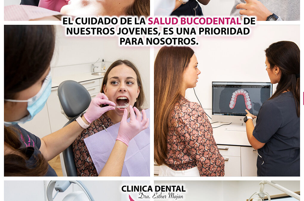 REVISIONES DENTALES PARA JOVENES Y ADOLESCENTES. REVISIONES BUCODENTALES PARA JOVENES. DENTISTAS CLINICA DENTAL ESPECIALIZADA EN JOVENES Y ADOLESCENTES EN MÓSTOLES.